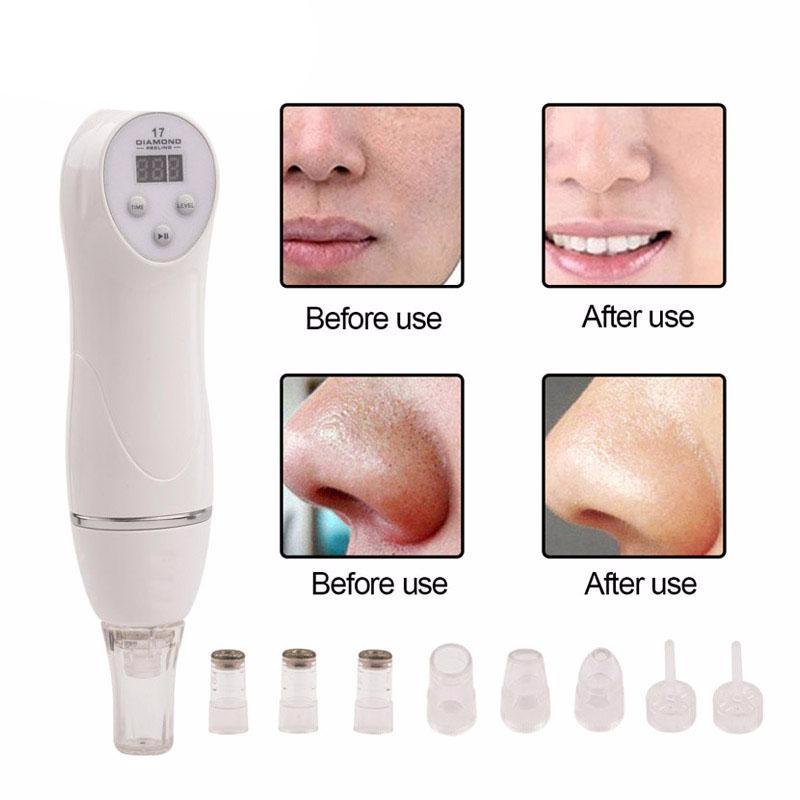 Facial Spa Diamond Peel Machine